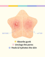 #OOTD Brightening Acne Spot Patch