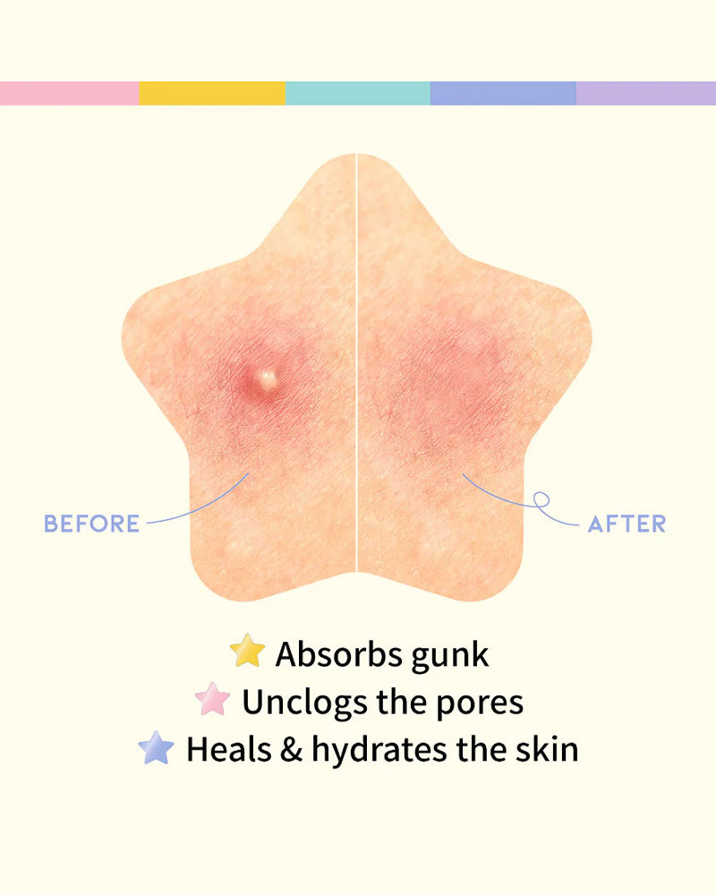 #OOTD Brightening Acne Spot Patch