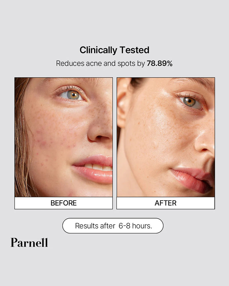 Parnell Cicamanu Clear Patch (68 patches)