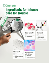 Acropass Trouble Cure Patch ingredients infographic: Oligopeptide-76, Niacinamide, Hyaluronic Acid, and more.