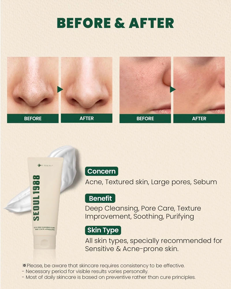 K-SECRET SEOUL 1988 Cleansing Foam Pine Cica 1% + Probiotics