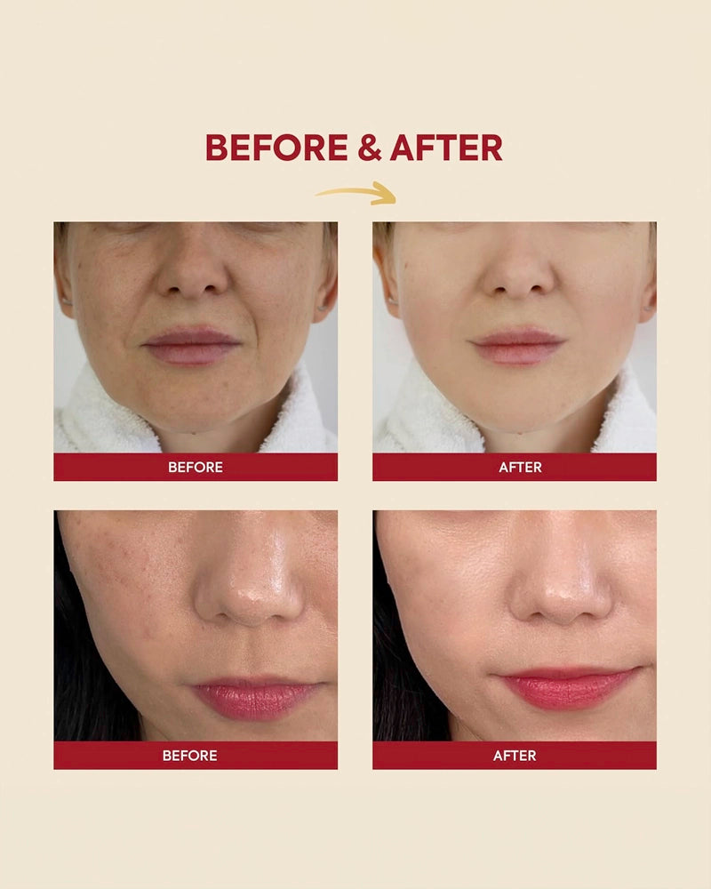 K-SECRET SEOUL 1988 Essence: Snail Mucin 97% + Rice