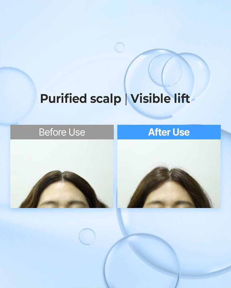 KUNDAL Airy Volume Hyaluron Hair Care Set #Blossom Breeze