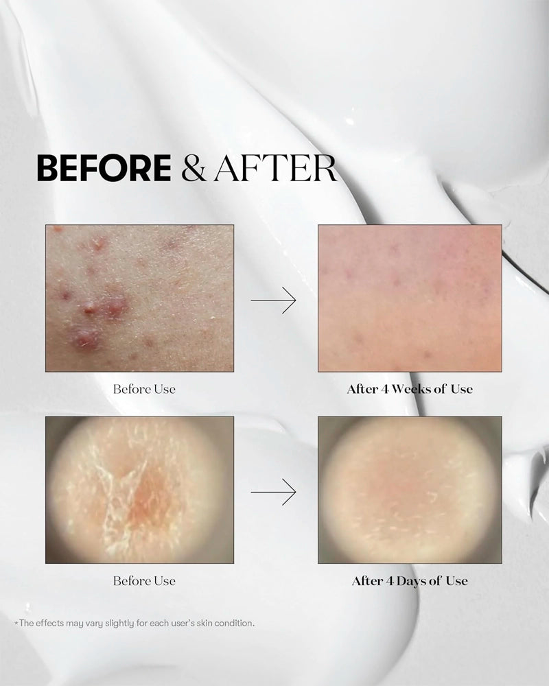 VT Collagen Reedle Shot 300