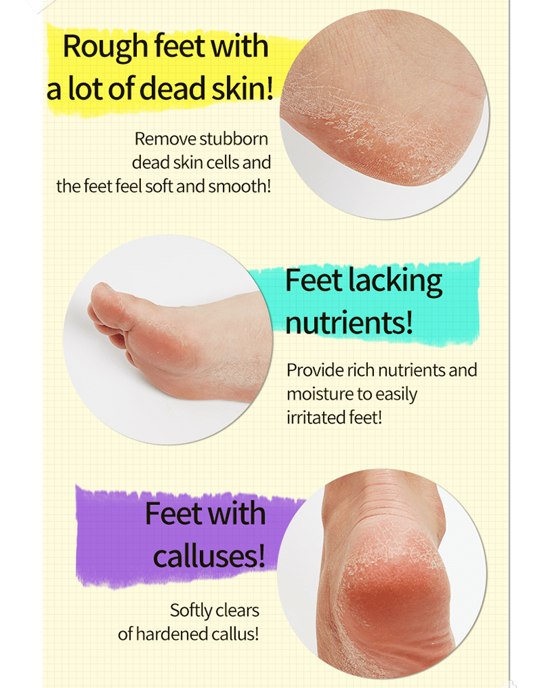 Chaussettes exfoliantes A'PIEU Soft Foot 30 minutes