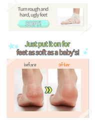 Chaussettes exfoliantes A'PIEU Soft Foot 30 minutes