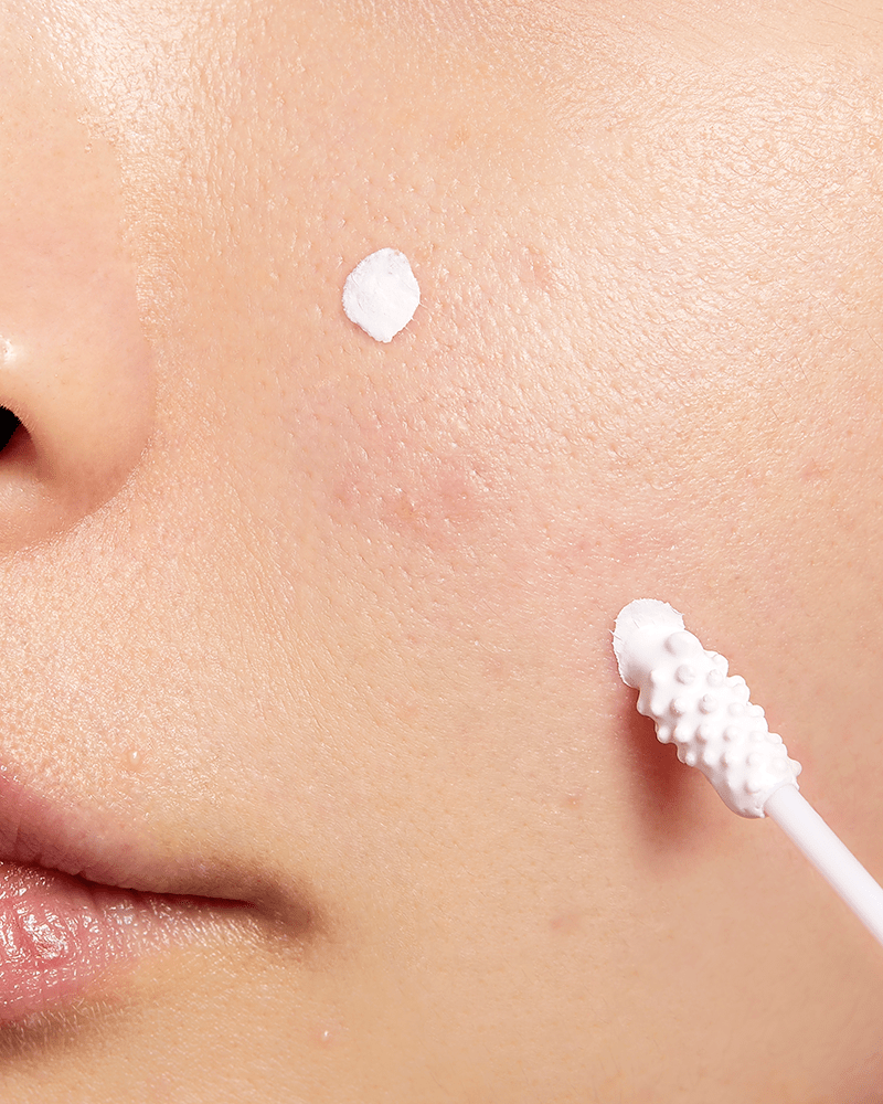 Lotion asséchante anti-imperfections COSRX AC Collection
