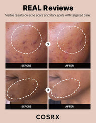 COSRX The Alpha-Arbutin 2 Discoloration Serum 50 mL