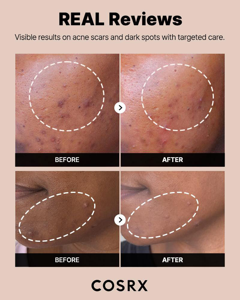 COSRX The Alpha-Arbutin 2 Discoloration Serum 50 mL