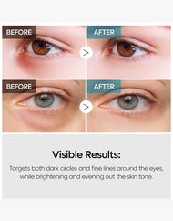 Dr. Melaxin Eyephalt : Crème pour les yeux pour les poches sous les yeux