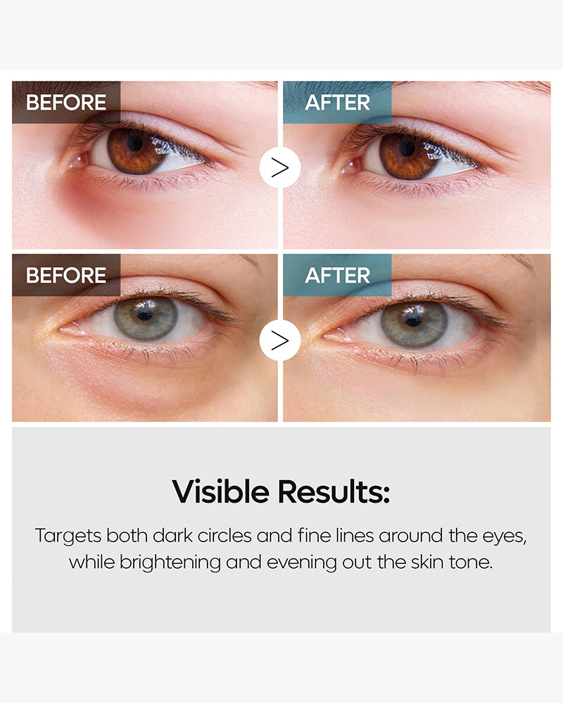 Dr. Melaxin Eyephalt : Crème pour les yeux pour les poches sous les yeux