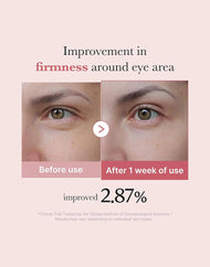 medicube PDRN Pink Peptide Eye Serum