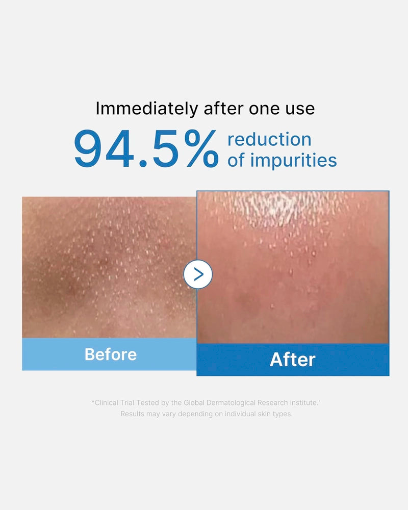 Travel/Mini - medicube Zero Pore Blackhead Deep Cleansing Oil 20ml