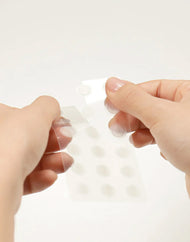 SOME BY MI 30 Days Miracle Clear Spot Patch