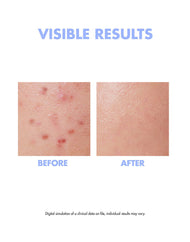 #OOTD Intensive Moisture Face Serum A.M