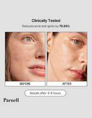 Parnell Cicamanu Clear Patch (68 patches)