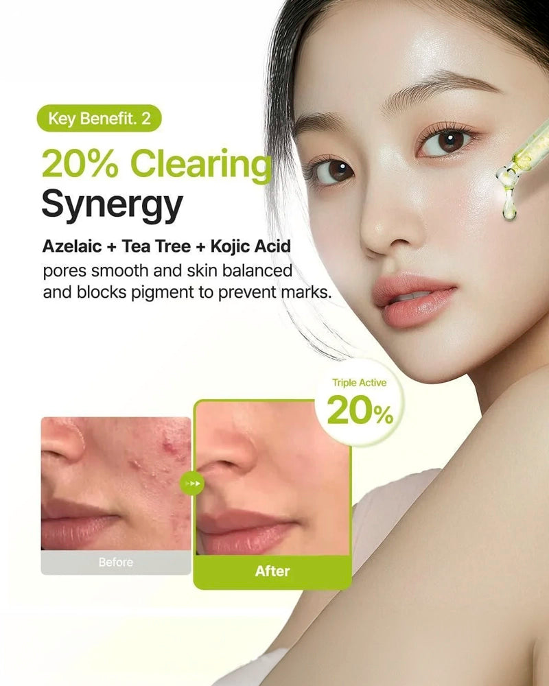 Purito SEOUL Azelaic Acid 10 Kojic Tea Tree Serum