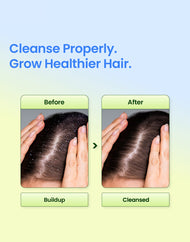 Seapuri Scalpy Root Vital Shampoo