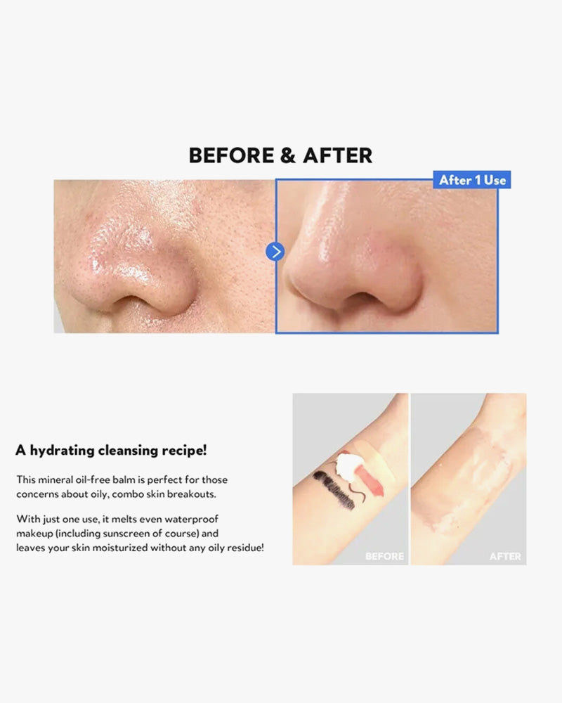 Tirtir Hydro Boost Enzyme Cleansing Balm